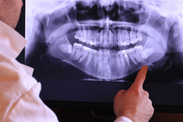 Best Walk-In Emergency Dental Services in Murraysville, NC