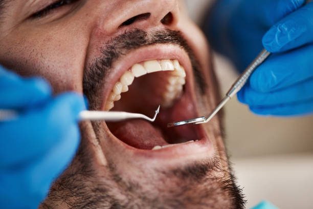 Best Emergency Pediatric Dental Care in Murraysville, NC